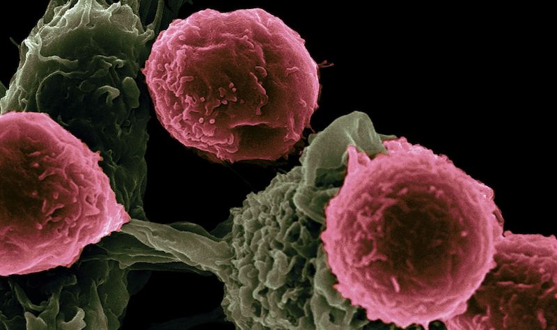 При каких видах рака применяется dostarlimab ? Единственный необходимый обзор.