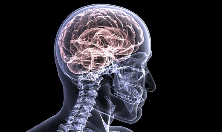 рентгеновский снимок человеческого мозга 